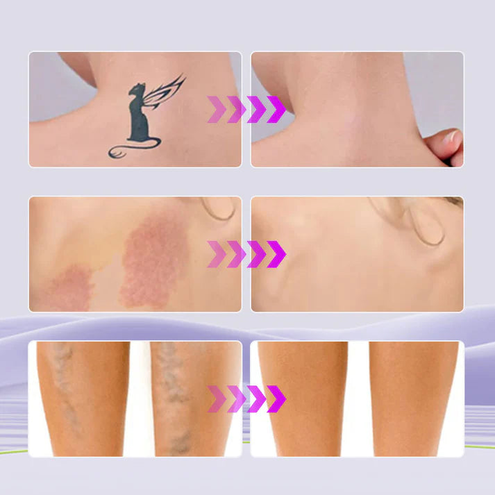 GlowDrop™ - Corrector Hidratante corporal Tono Claro